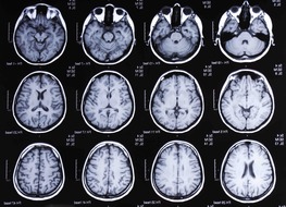 Patienten Inanspruchnahme nach Praxiskauf