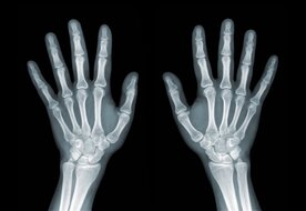 Patientenfrequenz nach dem Praxiskauf 